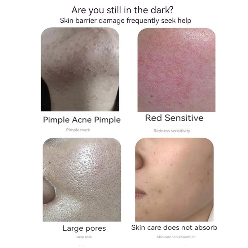 블루 구리 펩타이드 동결 건조 분말 세트, 올리고펩타이 - Oligopeptide Wrinkle 리뷰 및 가격